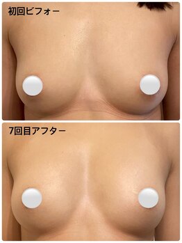 ハク 阪急茨木(HAKU)/ビフォーアウター