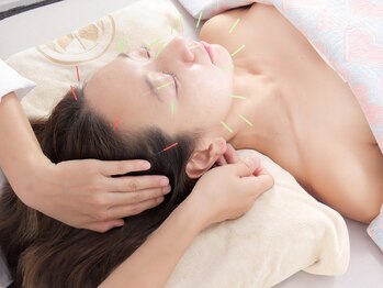 吉祥杏林鍼灸院/めぐりを高める、美顔鍼の力