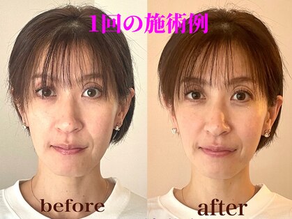 ラ アクサル(la.akthar)の写真