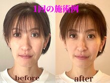 ラ アクサル(la.akthar)