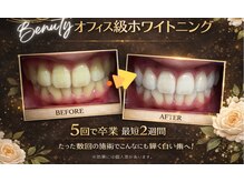 ホワイトニングプラス(Whitening+)の雰囲気（歯科衛生士在籍！しっかりサポートさせていただきます(^^♪）