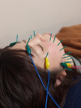 乃々鍼灸整体院 表参道/美容鍼