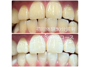 ホワイトニングルーム 横浜店(Whitening Room)/セルフホワイトニング/横浜