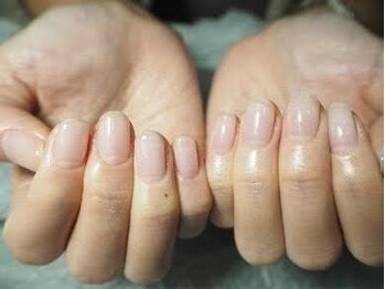 ネイルクローゼット(Nail Closet)の写真/綺麗に伸ばせない方、爪にコンプレックスがある方に◎パラジェル＆フィルインで爪をいたわり美しい指先へ♪