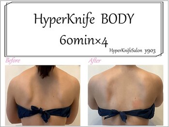 ワイキューマルサン(y903)/上半身60分×4回