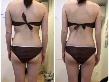 フェアリー 小松店/【痩身】THE華奢魅せ☆