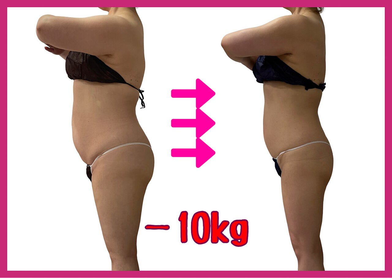 シュエットプラス(Chouette+)｜ホットペッパービューティー