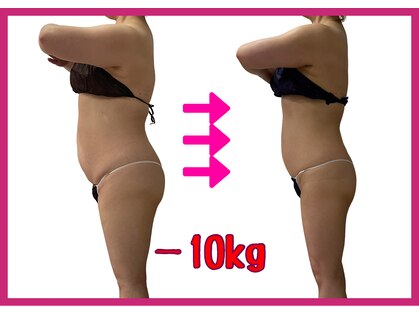 シュエットプラス(Chouette+)の写真