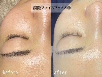 セレーノ 白金台(seReno)の写真/【肌が喜ぶオフ体験】潤艶WAX¥9800/繰り返す程美肌に*毛穴詰まり・黒ずみ・古い角質・産毛OFFで化粧ノリUP