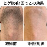 ちゃっちゃっ