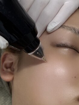 シミしわ改善！予防ケア