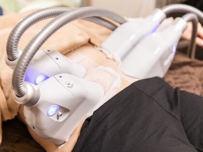 ビースリム(Be Slim)の写真