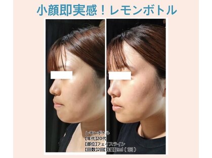 リファイン(REFINE)の写真