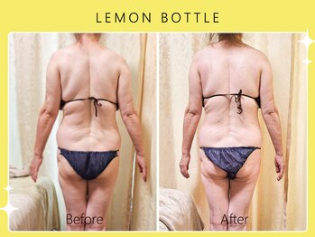 シロカネ 光の森店(SHIROKANE)/レモンボトル☆