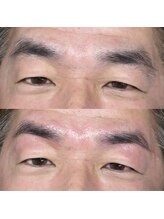 ブロウ(BROW)/【メンズ眉】before after