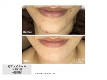 中国整体リラクゼーション 桜月/光フェイシャル