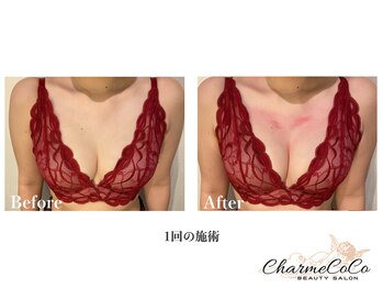 シャルムココ 蔵前店(CharmeCoCo)/お客様Before→After