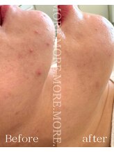 モア 吉祥寺(MORE.)/BeforeAfter