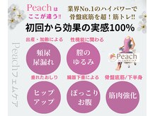 ピーチ鍼灸整体治療院(Peach鍼灸整体治療院)/尿漏れ/頻尿/子宮脱/産後ケア