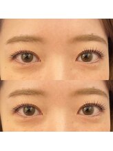 ノット(KNOOT)/似合わせまつ毛パーマ