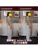 ワイルドボディ(WILD BODY)/姿勢矯正での改善例