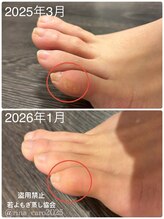 リレフー(Relafy)/姿勢が変わる？！