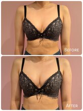 ククナ 上越店(KUKUNA)/20代（１回目）