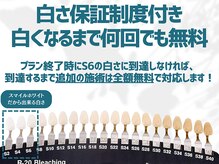 スマイルホワイト 赤羽店の雰囲気（エリア唯一の白くなるまで保証付きの医療提携ホワイトニング）