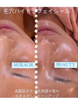 ミラー(MIRAOR)/毛穴もお顔角質もスッキリ☆