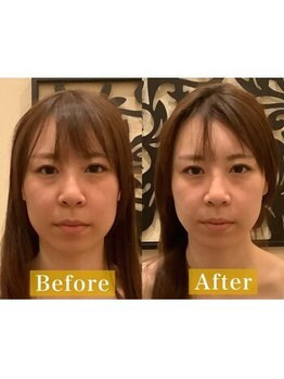 アジール 長岡リバーサイド千秋店(agir)/Before/After画像