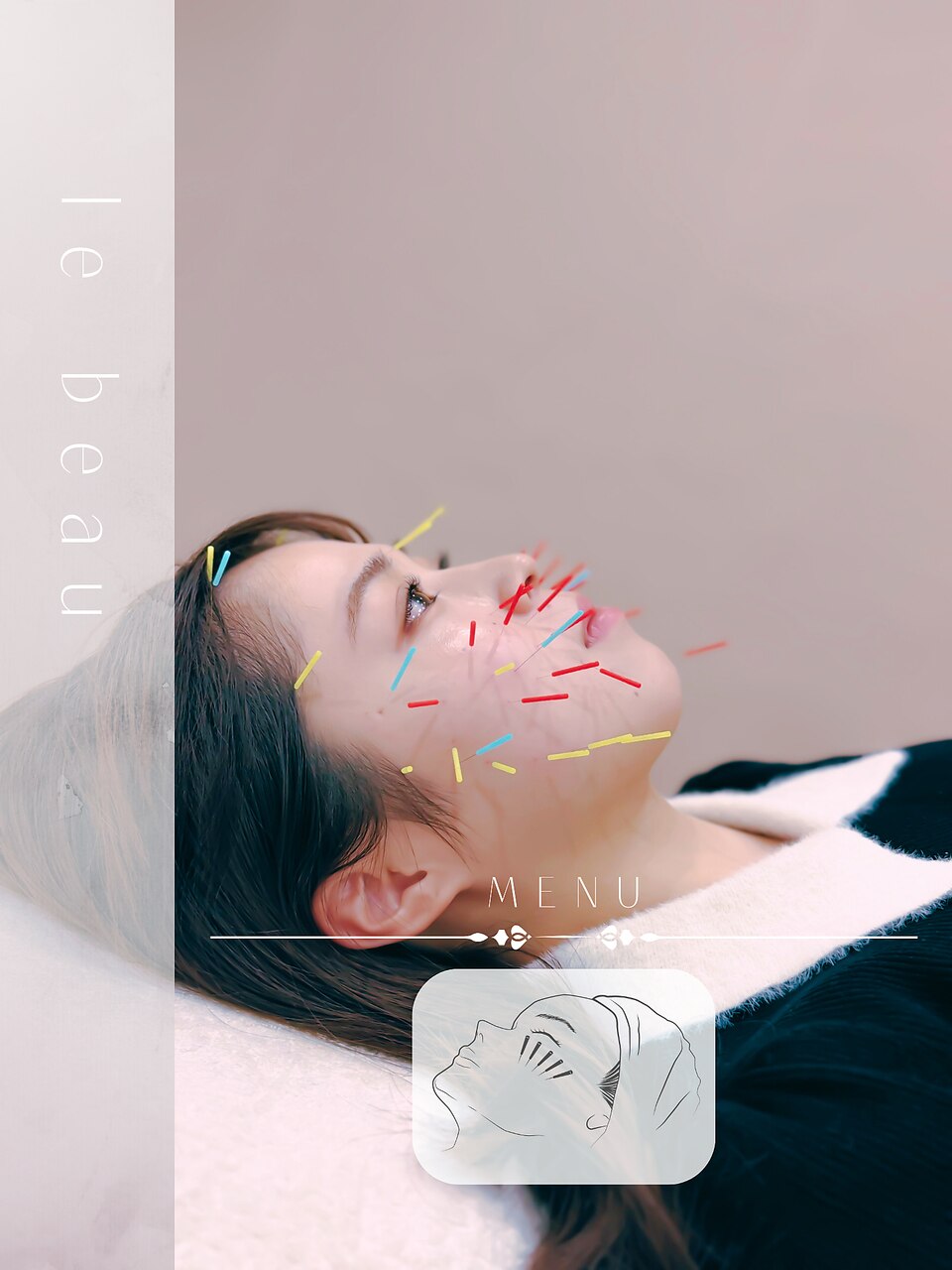 ＊初めてにオススメ＊【表情筋/むくみケア】美容鍼34本+パルス