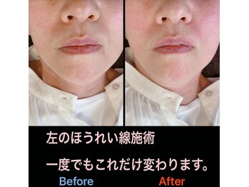 美容矯正サロン レレポノ(LELEPONO)/