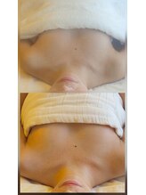 ディーバ 北浜(Diva)/デコルテまで美しく