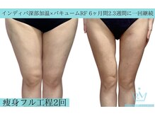 リメイク 広尾(REMAKE)/