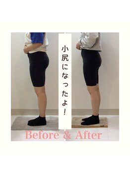 スタイルラボ高松/産後の骨盤矯正の効果♪