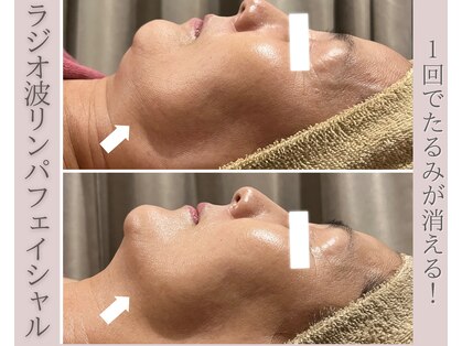 シストワ(sistoi)の写真