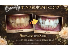 ホワイトニングプラス(Whitening+)の雰囲気（リニューアルしたオフィス級ホワイトニング♪ご体感ください♪）