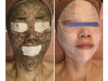 ナチュール(NaTuRu)/リアボーテハーブトリートメント