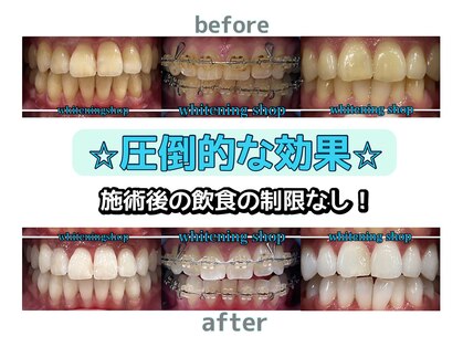 ホワイトニングショップ 亀戸店の写真