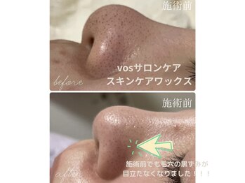 サロン ド ボーテ ラーンジュ 岐阜店(salon de beaut'e L'ange)/本気の肌改善毛穴、ニキビ、小顔