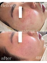 モア 吉祥寺(MORE.)/Before after