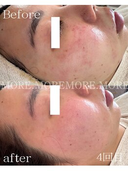 モア 吉祥寺(MORE.)/Before after