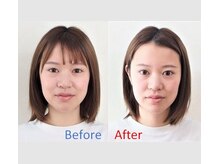 ひらばり ハッピー整体/ハッピー小顔整体（小顔矯正）