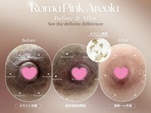 ヴァーチュ(Virtue)の雰囲気（話題のローマピンク★メラニン除去術で、ニップルのお悩み解決！）