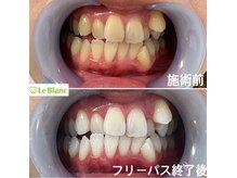 ルブラン 奈良店(Le Blanc)/回数を重ねる程確実に白く！