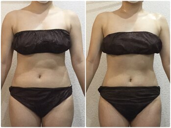 美容整体 ウェリナ 蟹江院/小顔矯正/骨盤矯正/美脚サロン