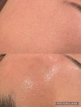 ウォーム(Warm)/毛穴×ハーブ×プラズマの力