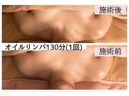 プリズミント(Prismint)の写真