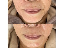 ベルアイラッシュ(Belleyelash)/【フェイシャルワックス】