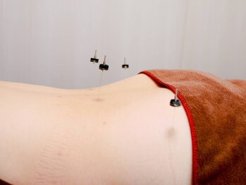 ノア鍼灸院 温灸堂(NOA鍼灸院)/